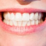 Ładne zdrowe zęby także świetny przepiękny uśmieszek to powód do płenego uśmiechu.